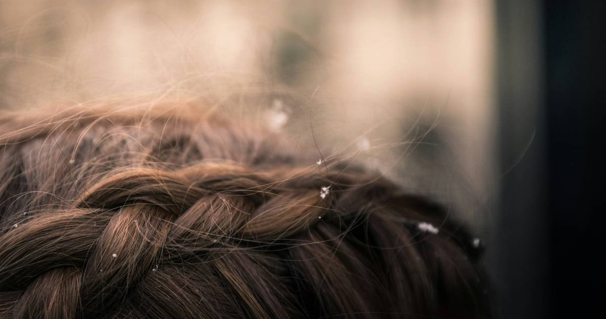 Snowy Braids